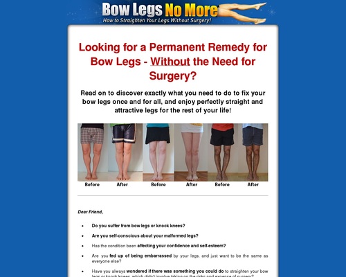 Bow Legs No More – How to Straighten Your Legs Without Surgery! Honest Review in 2023